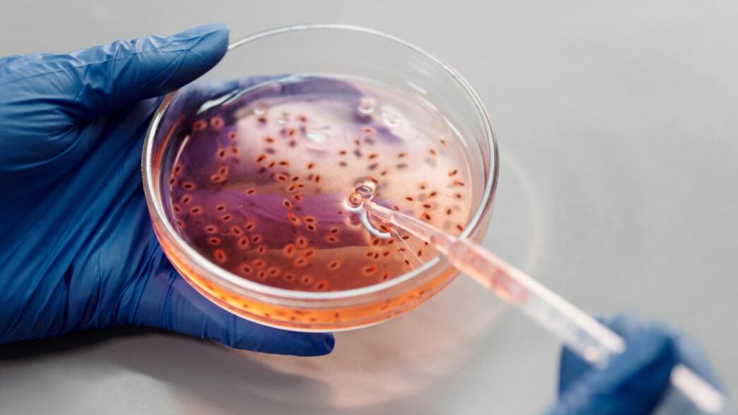 Gloved hands holding a petri dish with liquid and pipette.